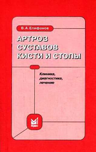 Онлайн книга - Артроз суставов кисти и стопы: клиника, диагностика, лечение - Виталий Александрович Епифанов