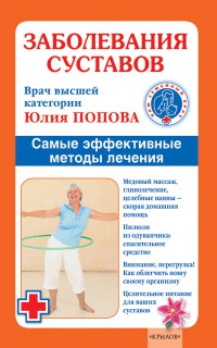 Онлайн книга - Заболевания суставов. Самые эффективные методы лечения - Юлия Попова